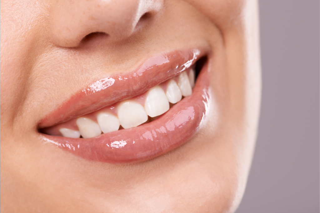 Gros plan sur une personne souriante, dévoilant des dents blanches et impeccables ainsi que des lèvres brillantes. La peau est lisse et l'arrière-plan est d'une couleur douce et neutre : une illustration parfaite des résultats éclatants que vous pouvez obtenir au cabinet dentaire Casablanca avec le Dr Ikram Elouafi, dentiste.